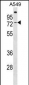 GBP3 Antibody (C-term)